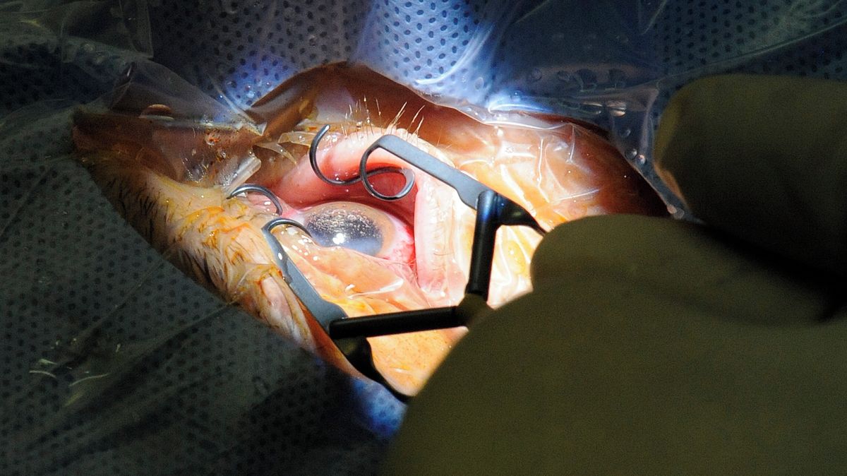 Šedý zákal: Nečekejte, až „dozraje“